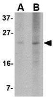 PUMA antibody [2A8F6]