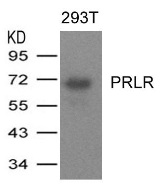 Prolactin Receptor antibody