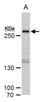 SETD1A antibody