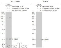 SNAI1 antibody