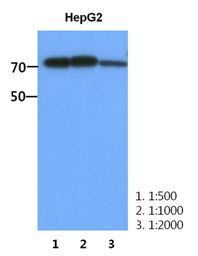 PFKM antibody [AT2F11]