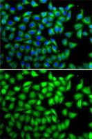 Suppressor of Fused antibody