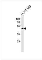 YB1 antibody, C-term