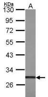 TIS11B antibody [N1C1]
