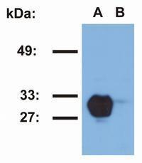 HLA-DR1 antibody [MEM-267] (PE)