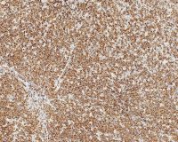 Bcl-2 antibody [bcl-2/100/D5]