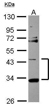 StARD7 antibody [N1C2]