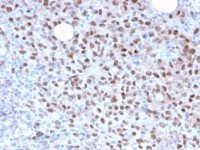 MITF antibody [MITF/2987R]