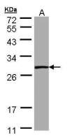 PSPH antibody