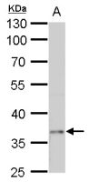 PTF1A antibody