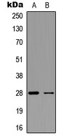 FGF23 antibody