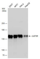 LATS1 antibody