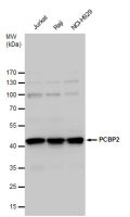 PCBP2 antibody