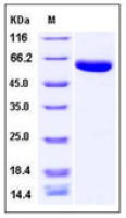 Human Carboxypeptidase B2 protein, His tag