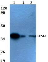 Cathepsin L antibody