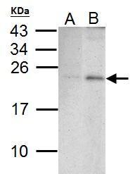 PUMA antibody [C2C3], C-term