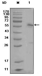 Estrogen Receptor alpha antibody [2G112B3]