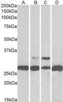 PGAM1 / PGAM2 / PGAM4 antibody, C-term
