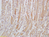 Senataxin antibody