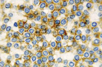 CD11c antibody [5D11]