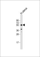 Aromatase antibody, C-term