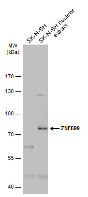 ZNF599 antibody