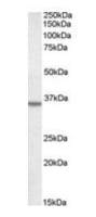 Annexin II antibody