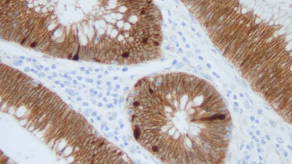 beta Catenin antibody [17C2]