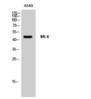 5-HT6 receptor antibody