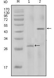 IL2 antibody [8D5]
