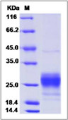 Mouse MCP1 / CCL2 protein, His tag