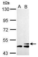 HMGCS2 antibody