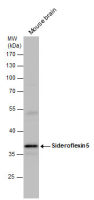 Sideroflexin 5 antibody