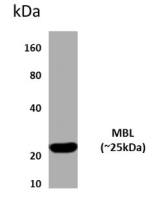 MBL2 antibody [4J25]