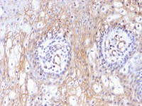 CD59 antibody [MACIF/629]