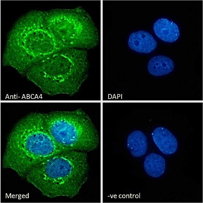 ABCA4 antibody, C-term