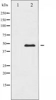 CaMK2 alpha/delta antibody