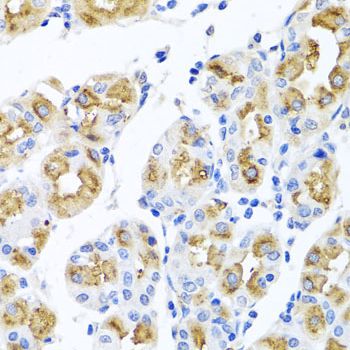 Ferrochelatase antibody