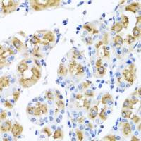 Ferrochelatase antibody