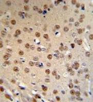 WTX antibody, Internal