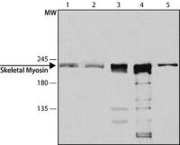 Myosin skeletal fast antibody [MY-32]