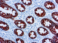 Cytokeratin 8 antibody [35βH11] (ready-to-use)