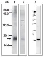 Plasmodium falciparum Ferredoxin antibody