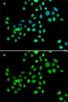 Macro H2A.1 antibody