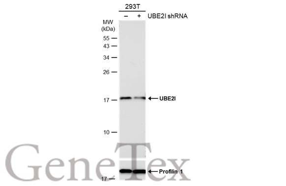UBE2I antibody