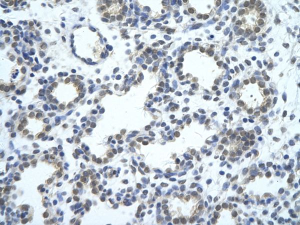SRBD1 antibody, N-term