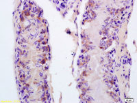 FASTKD5 antibody