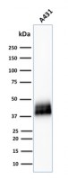 TACSTD2 antibody [TACSTD2/2151]