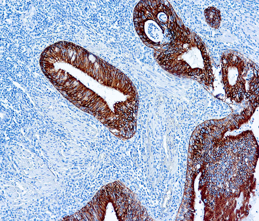pan Cytokeratin antibody [AE1/AE3] (ready-to-use)
