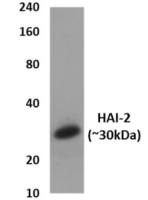 HAI-2 antibody [3S24]